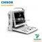 medical b/w 2d portable ultrasound Chison eco 3