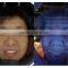 3D NLS non linear diagnostic system magic mirror skin analyzer