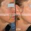 Vertical Apolomed 1540nm fractional for laser skin resurfacing and scars