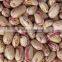 we are supply speckled Kidney Beans with good quality for sale