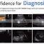 MY-A028G 2020 hot selling medical instrument 128 element cheap trolley ultrasound scan machine doppler