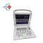 HC-A004 Cheapest Good Quality Medical Full Digital Portable Laptop B/W Ultrasound Scanner for Pregnancy
