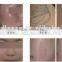 Best Price Mini q Switch 1064 nm 532nm nd Yag Laser Home Use Tattoo Removal Skin Rejuvenation Beauty Salon Mahicne