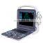 Hot selling 12 inch color ultrasound doppler machine for clinic and home use