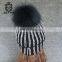 2017 Ball For Women Warm Fur Hat Knitting Cap