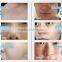 2016 Popular portable shr hair removal machine for salon use