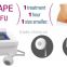 2016 13mm focal depth best way to lose weight skin ultrasound portable ultrasound machine