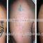 advanced big power q switched nd yag laser/high energy laser tattoo removal/pain free q switched nd yag laser