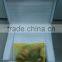 Beauty equipment stand rbs emoval Telangiectasia/vascular lesion/blood vessels removal laser machine