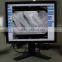 Digital Radiography System