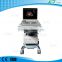 LTC5 medical clinic PC Based color doppler Laptop Ultrasound equipment