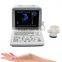 OEM supply 12 inch laptop Ultrasound Scanner Ultrasonic machine B ultrasound scanner for sale