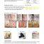 Spot Scar Pigment Removal Hot 15W(20W) Co2 1-50J/cm2 Fractional Surgery Laser Equipment(CE&ISO) Fine Lines Removal