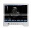 B Mode Portable Ultrasound Price TS20
