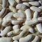 New Crop Dry White Kidney Beans For Sale