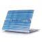 Pattern Printing Hard Shell Protective Case for Macbook New Macbook 12" inch Retina [2015 Release]( Jeans )
