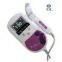 Sonoline C Fetal Doppler (Sonoline C)