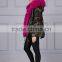 Hot Pink Thick Part Fox Fur Trimmed Luxury Ladies Fashion Short Parka