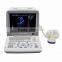 OEM design 2 probe connector 1 USB 12-inch LCD monitor Full Digital LED Ultrasound Scanner