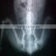 xray film portable x ray equipment used 14*17inch China Factory