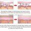 2mhz The Top Quality Vacuum Cavitation Body Contouring System Salushape Hifu For Fat Removal
