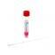 Monkeypox Virus Transport Medium with Sterile Nylon Flocked Swab for Mpox Detection