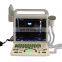 Image review & storage fully digital laptop ultrasound machine color doppler scanner device