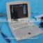 MSLVU08 2015 hottest type portable laptop vet equine ultrasound equipment
