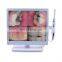 MY-M067-1 intra oral camera medical dental equipment wifi wireless intraoral camera dental