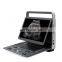 Portable Laptop Sonoscape E2 Ultrasound Machine Color Doppler Ultrasound Device System
