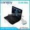 CE approved Laptop Ultrasound Scanner/machine with Convex Linear Probe/Transducers price