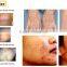 IPL SHR laser Permanent hair removal & skin care machine ipl hair removal machine