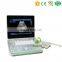 MY-A009 Crystal-clear Image 15inch screen PC based laptop ultrasound B scanner