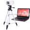 gynaecology diagnostic equipment/vagina examination/video colposcope manufacturer in China