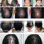 high performance hair growth spray laser machine for hair loss therepy