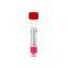 Monkeypox Virus Transport Medium with Sterile Nylon Flocked Swab for Mpox Detection