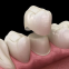 Dental Zirconia Crown Cercon,Dental Teeth, Laboratoire Dentaire, Dentallabor, China Dental Lab