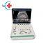 HC-A006A Hot Sales Ultrasound Scanner 3d 15 Inch LED Ultrasound Scanner Medical Equipment