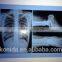 blue dry X Ray medical Film/cheap films the most popular film