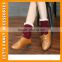 Hot sales Autumn & Winter Button Lace top Knitting Warm Socks Leg Warmers Girls Knee High Leg Warmer PGLW-0012