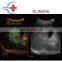 High Performance Sonoscape S60 Medical Diagnostic color doppler trolley ultrasound system