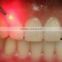 Dental equipment supplies / Semiconducture dental laser