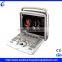 Portable Doppler Ultrasound Machine