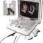 MC-DU-Q8 High Class Portable OB/GYN 3D/4D Cardiac Color Doppler Ultrasound Scanner