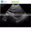 200mm Scanning depth wireless ultrasound probe -WBU01