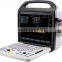 Ultrasonic system pregancy doppler machine portable color doppler price