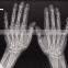 Konida medical x-ray film agfa laser film