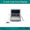 CE Approved 12 inch Color Fetal Baby Monitor(Toco, FHR) RFM-300C-Shelly