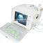 Portable ultrasound scanner USG diagnostic system with convex linear transvaginal micro-convex rectal probe optional