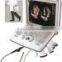MC-DU-Q8 Portable OB/GYN 3D/4D 4d portable ultrasound machine